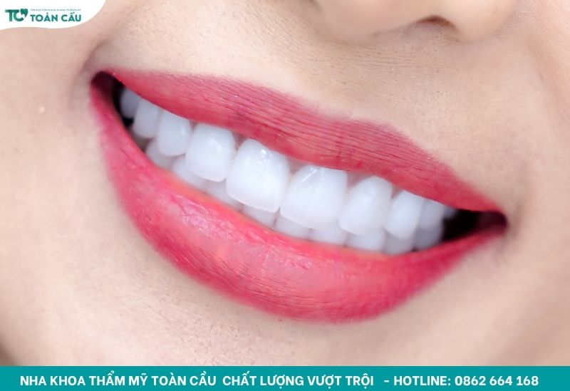 Mão sứ ôm khít chân đường viền nướu