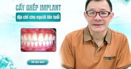 Cấy ghép implant ở đâu an toàn tại TPHCM cho người lớn tuổi?