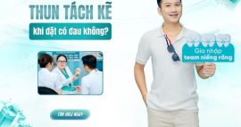 Đặt thun tách kẽ có đau không và mất bao lâu để hoàn tất?