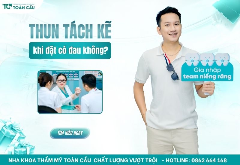 Đặt thun tách kẽ có đau không và mất bao lâu để hoàn tất?