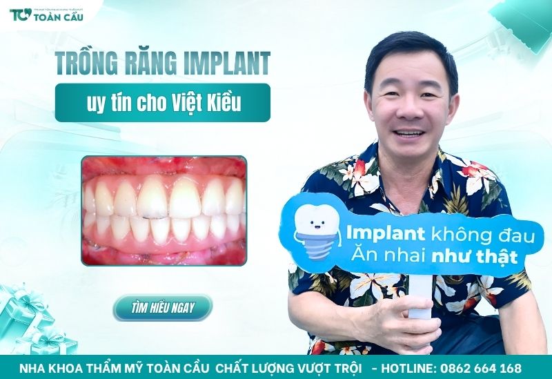 Địa chỉ trồng răng implant uy tín cho Việt Kiều tại TPHCM 1 địa chỉ trồng răng implant uy tín cho Việt Kiều