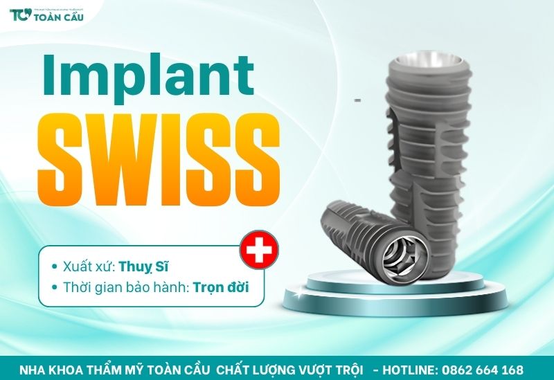 Địa chỉ trồng răng implant uy tín cho Việt Kiều tại TPHCM 4 Sử dụng trụ implant nhập khẩu