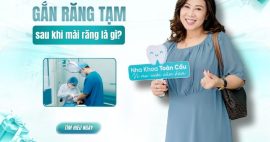 Gắn răng tạm sau khi mài răng là gì và vì sao cần thực hiện?