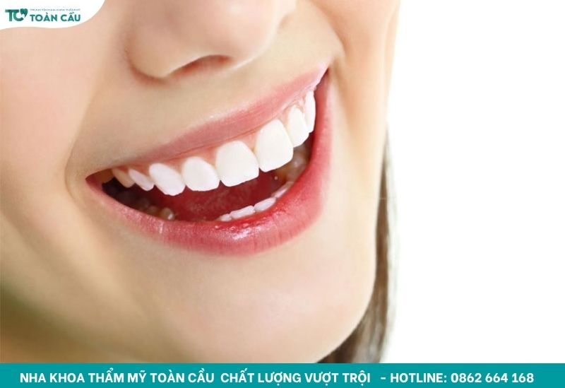 Răng mọc thẳng hàng