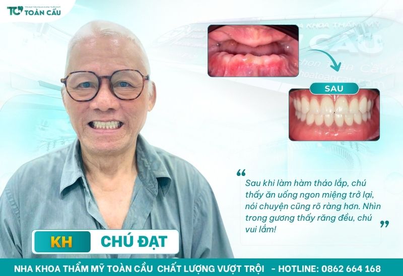 Địa chỉ làm hàm tháo lắp uy tín