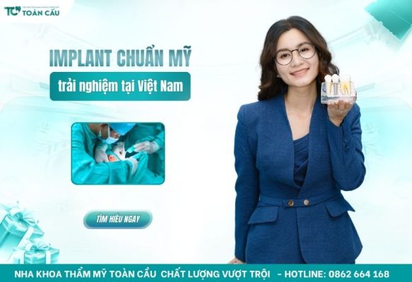 implant chuẩn Mỹ tại Việt Nam