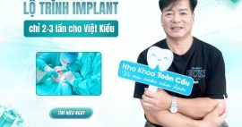Lộ trình làm implant cho Việt Kiều