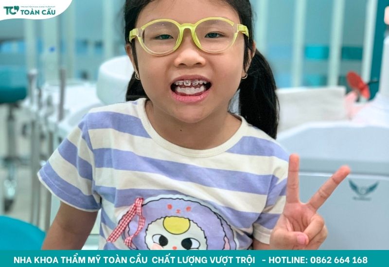 Niềng răng cho trẻ 7 tuổi giá bao nhiêu?