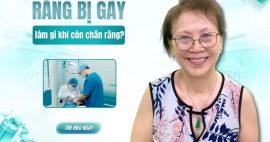 Răng bị gãy còn chân răng thì phải làm sao để khôi phục lại?