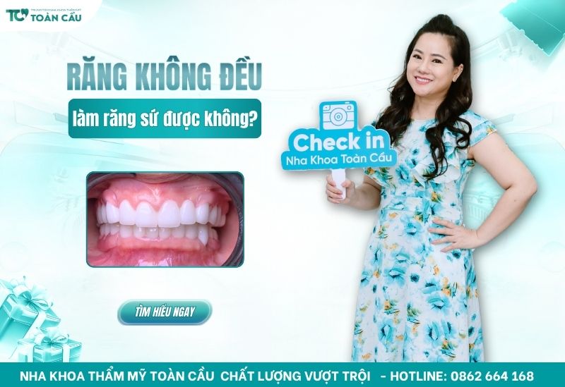 rang khong deu co lam rang su duoc khong 1