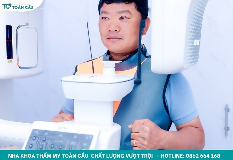 Chụp phim CT Cone Beam 3D