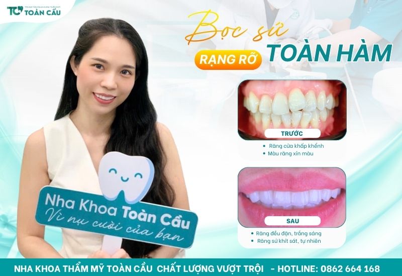 Khách hàng bọc răng sứ toàn hàm - Nha khoa Toàn Cầu