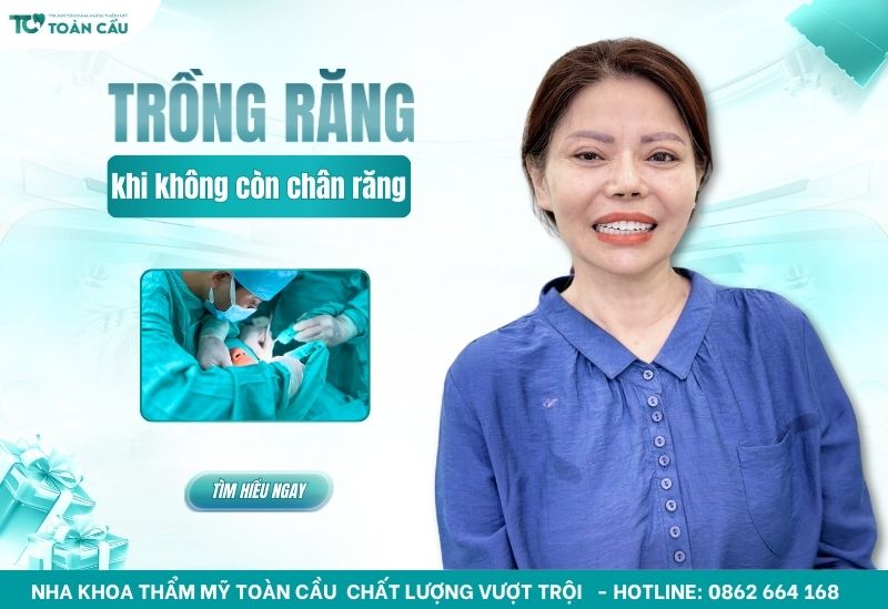 Giải pháp trồng răng khi không còn chân răng bằng implant