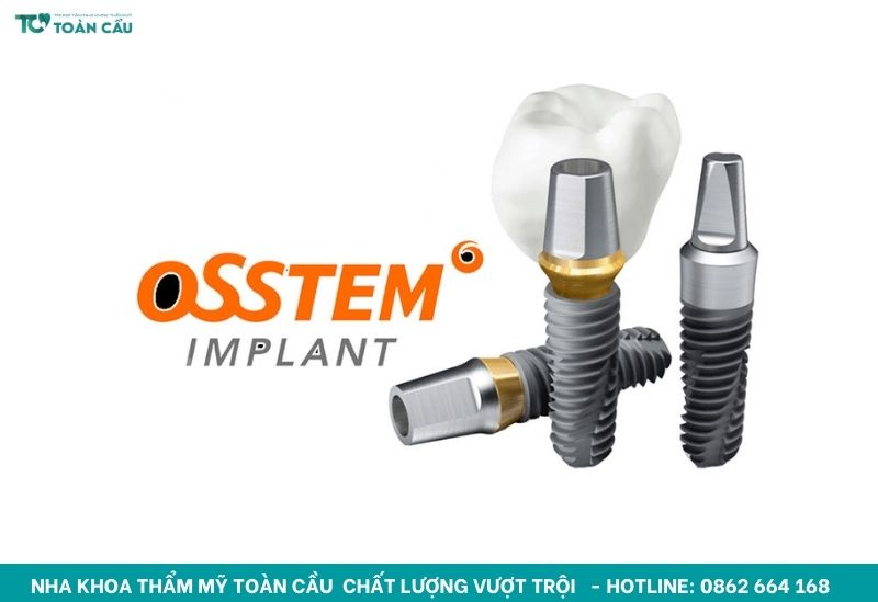 Trụ implant Hàn Quốc