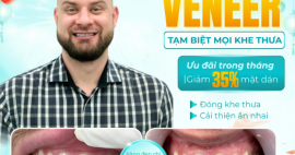 Veneer sứ cho Việt kiều – Giải pháp làm răng đẹp, tiết kiệm thời gian khi về Việt Nam