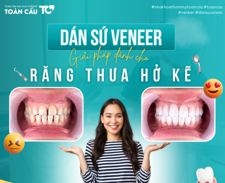 venner viet kieu 2