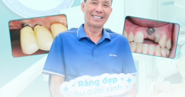 Trồng răng Implant cho người lớn tuổi: Có an toàn không?