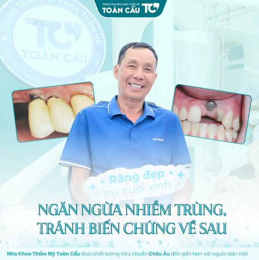 trong rang implant cho nguoi lon tuoi co an toan khong 3