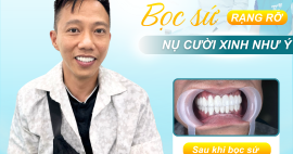 Bọc răng sứ có bị ê buốt không? Nguyên nhân và cách khắc phục