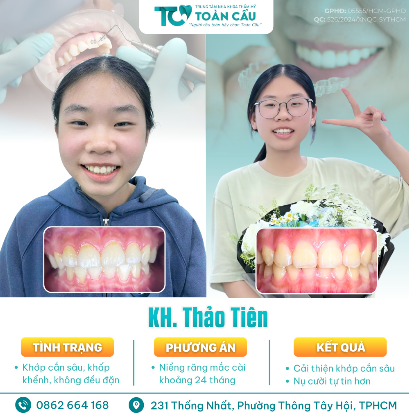 trong rang implant co an toan cho nguoi lon tuoi khong 1 1