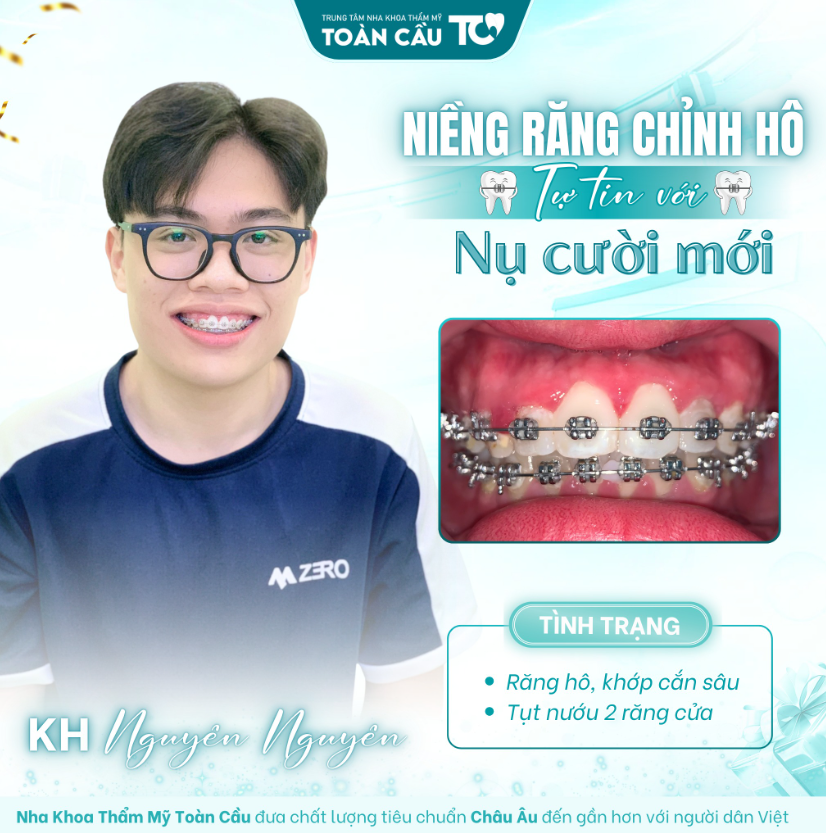 trong rang implant co an toan cho nguoi lon tuoi khong 3 1