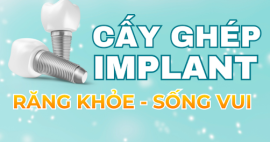 Trồng răng Implant có tiêu xương không? Sự thật nhiều người hiểu sai