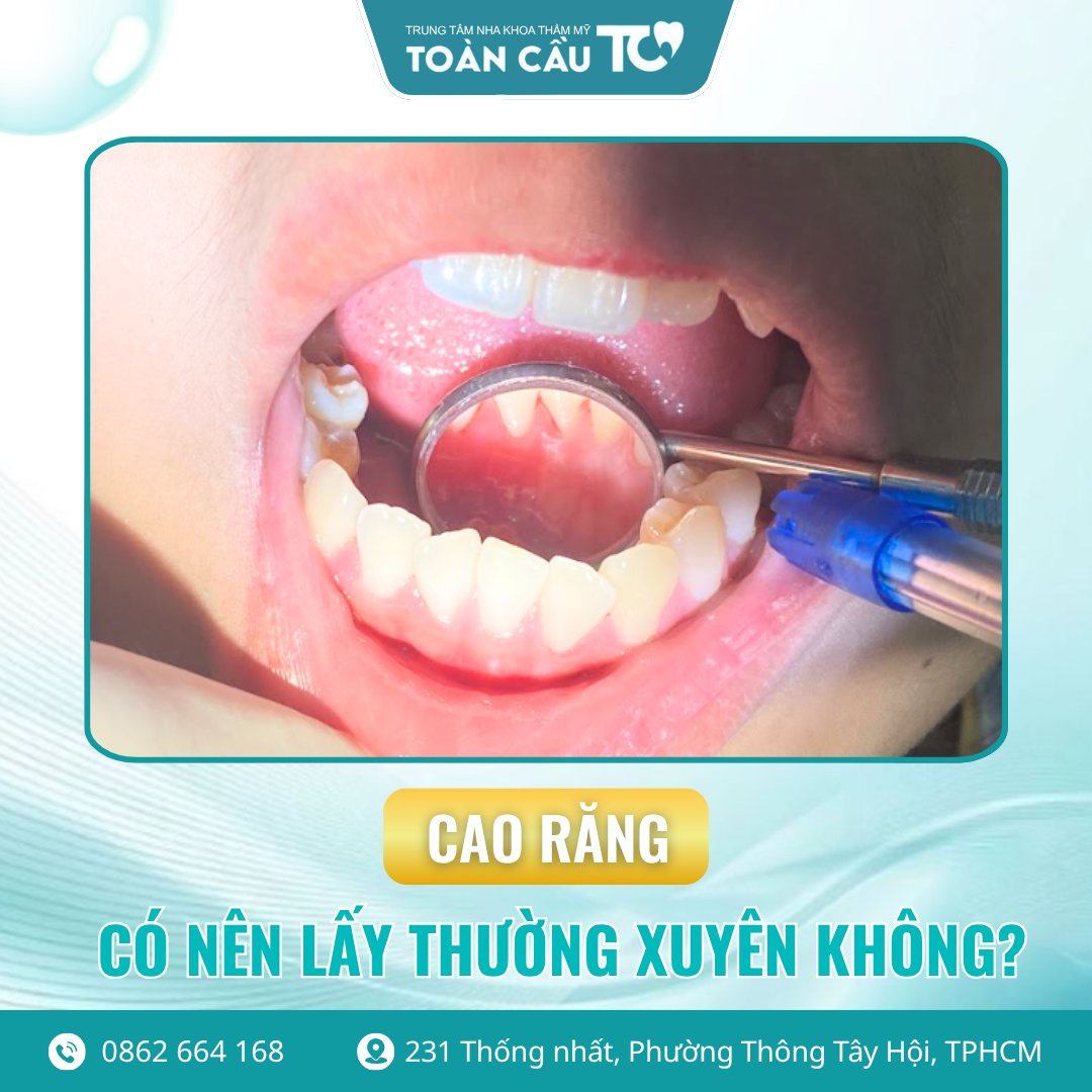 cao rang la gi co nen lay thuong xuyen khong 3