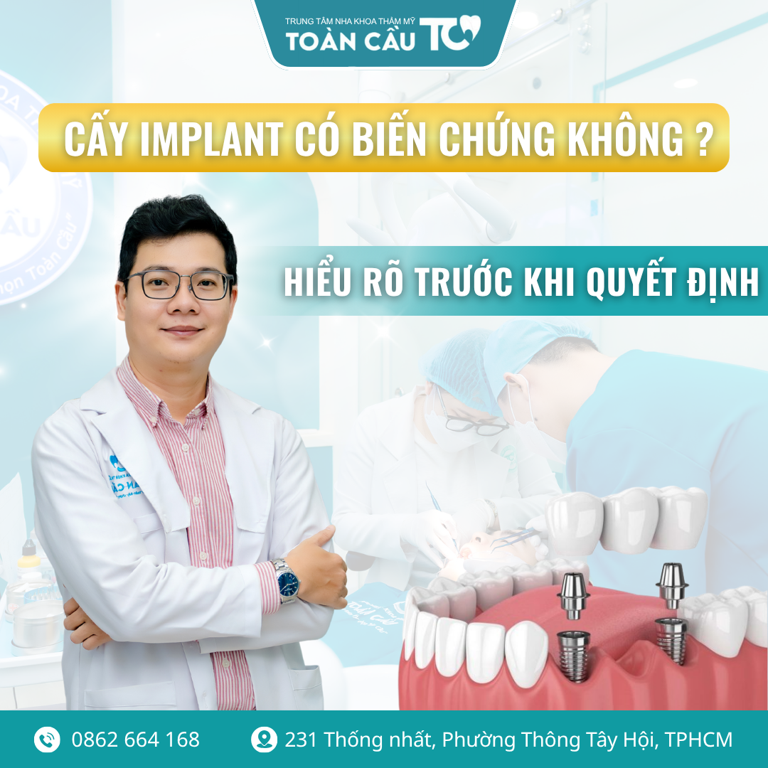 cay implant co bien chung khong 5 quy tac vang de phau thuat an toan 1