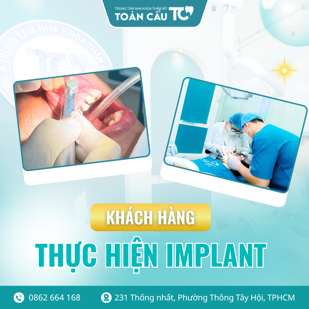 cay implant co bien chung khong 5 quy tac vang de phau thuat an toan 3