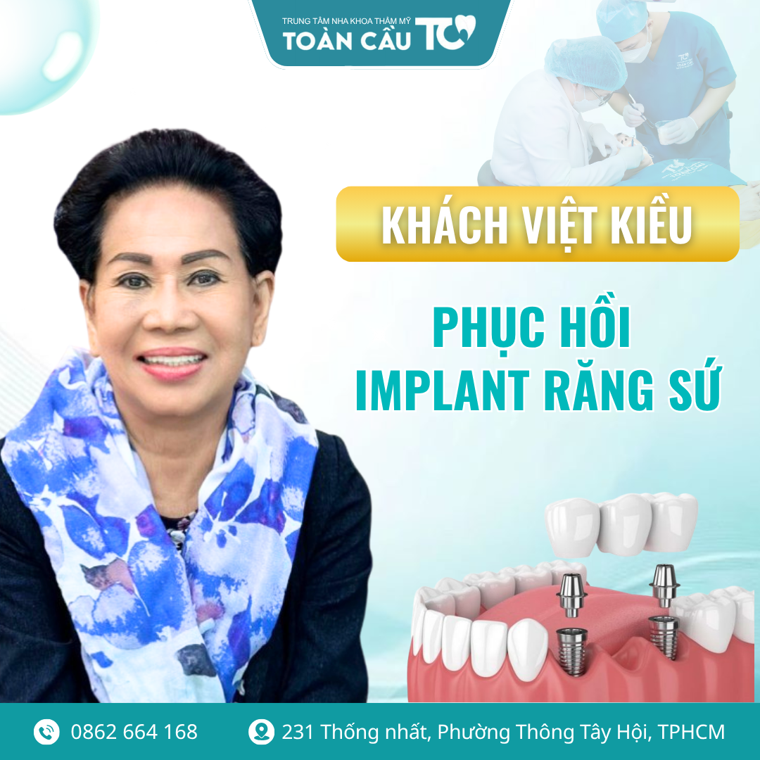 lam rang o viet nam co tot khong review thuc te tu viet kieu ve nuoc 1