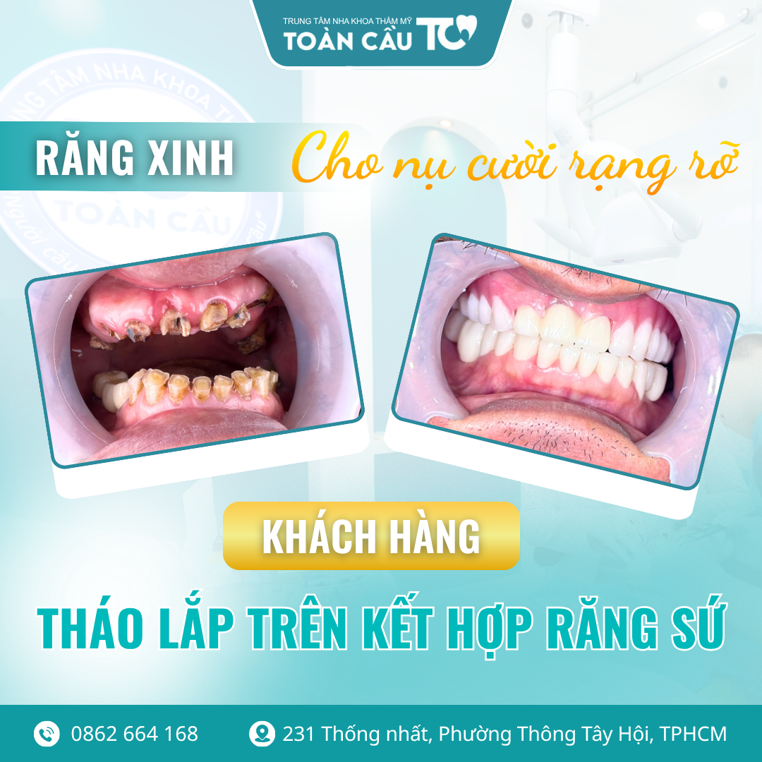 lam rang o viet nam co tot khong review thuc te tu viet kieu ve nuoc 3