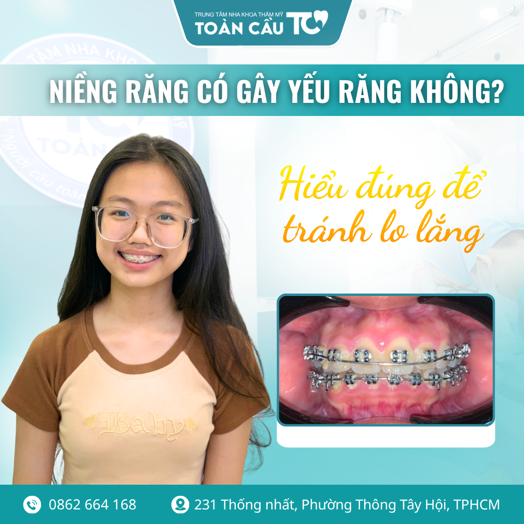 nieng rang co lam yeu chan rang khong loi khuyen tu bac si chuyen khoa 2