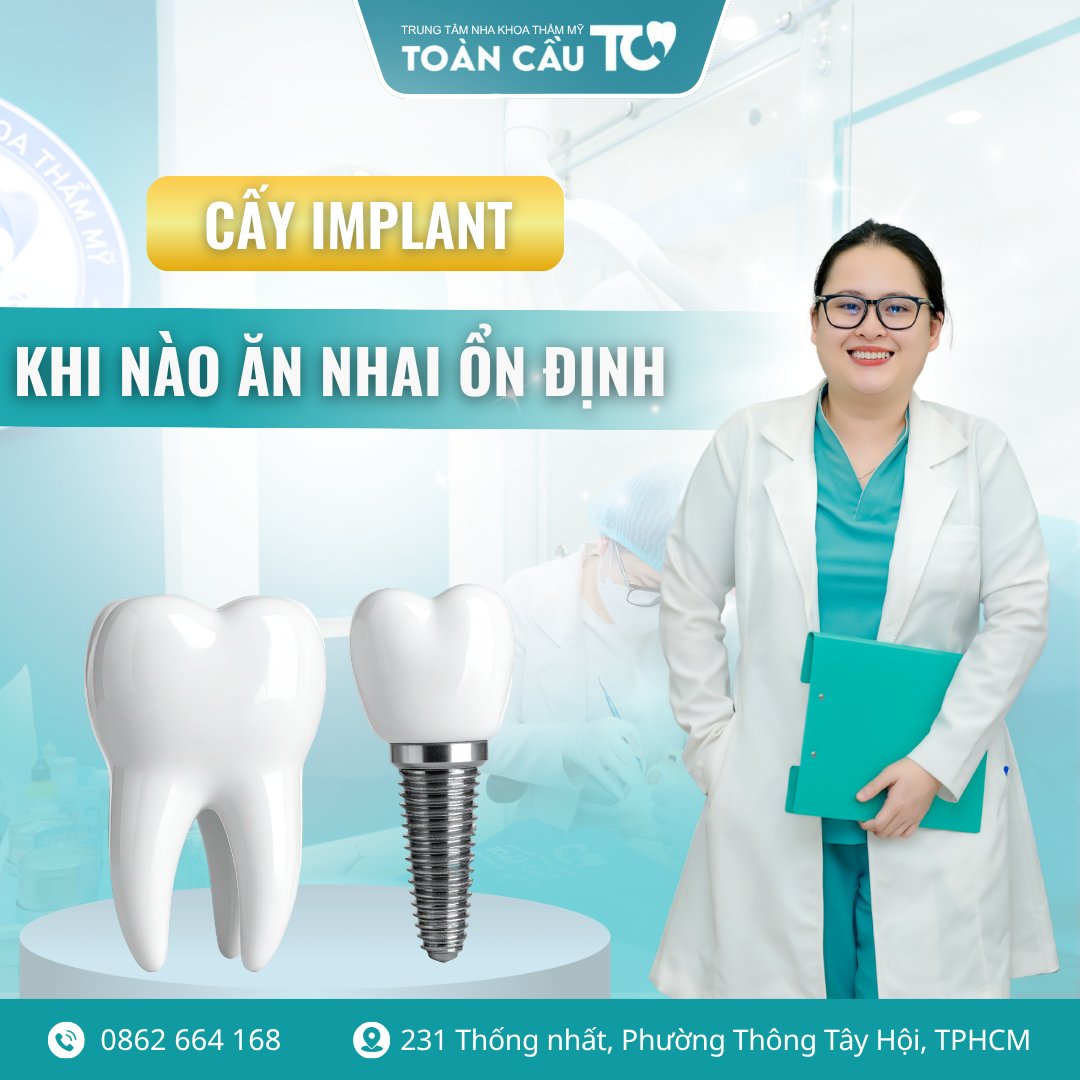sau khi cay implant bao lau an nhai binh thuong lo trinh hoi phuc tu a z 3