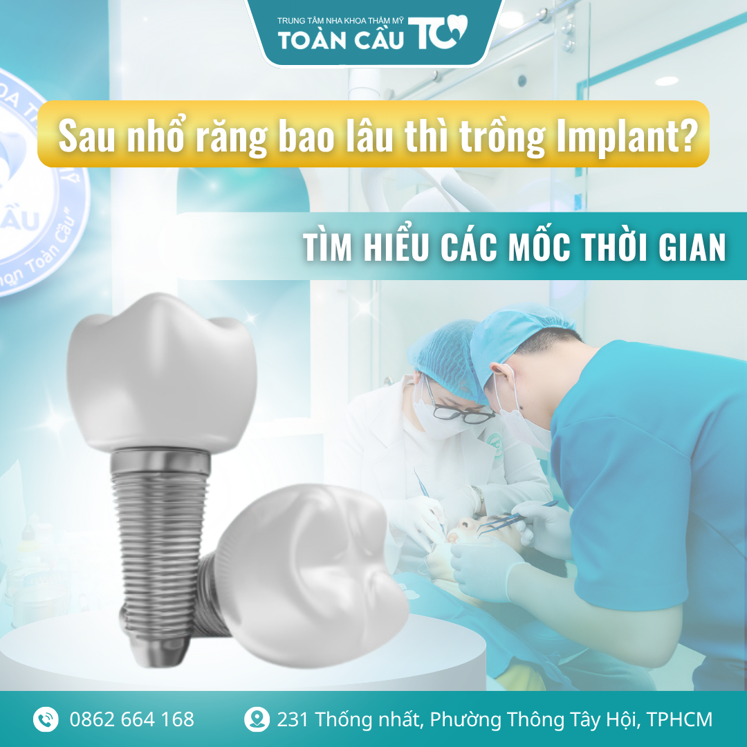 sau nho rang bao lau thi trong implant thoi diem vang de tiet kiem chi phi 1