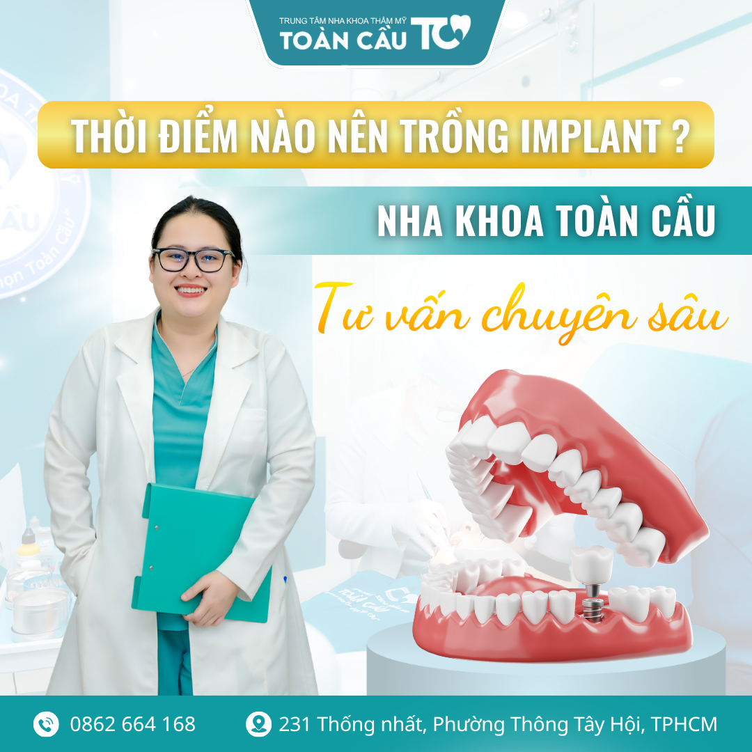 sau nho rang bao lau thi trong implant thoi diem vang de tiet kiem chi phi 2